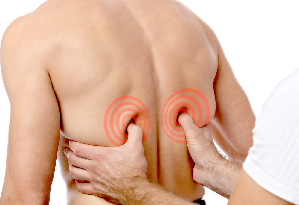 Alternatif Akupuntur