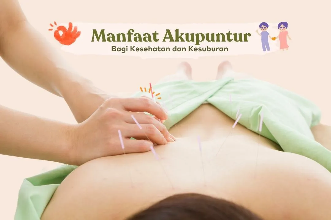 Kebaikan Akupuntur
